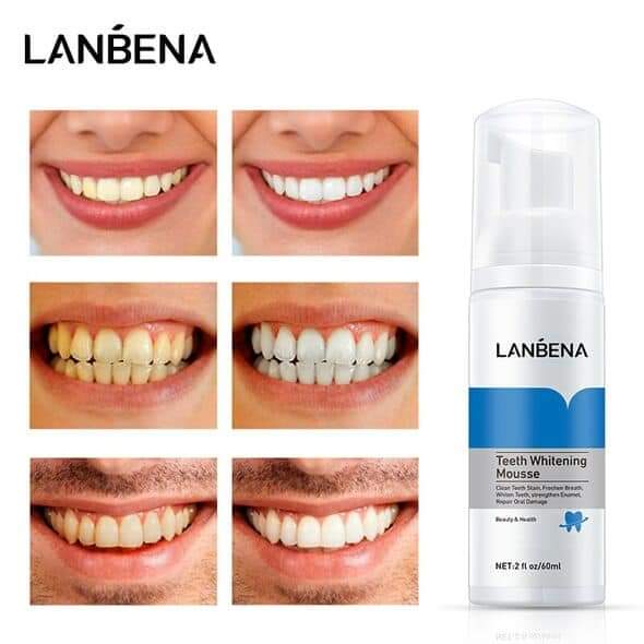 Lanbena Blanchiment Des Dents Mousse Dentifrice Dentaire 60ml