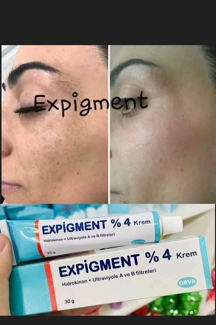 Expigment Crème Hydroquinone 4% 30g