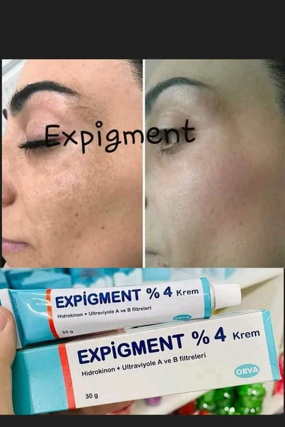 Expigment Crème Hydroquinone 4% 30g