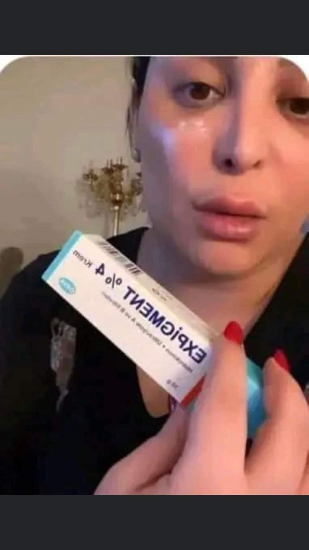 Expigment Crème Hydroquinone 4% 30g
