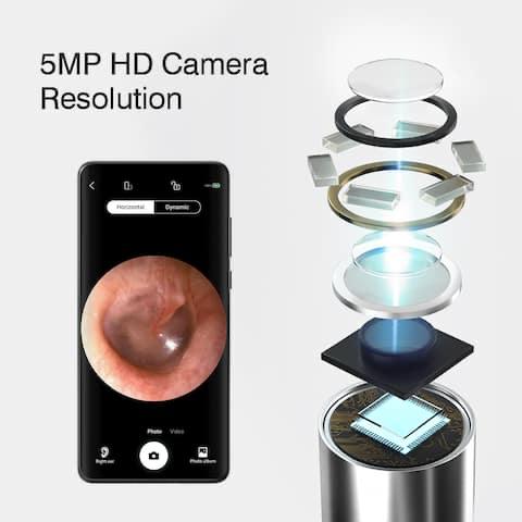 Mini caméra Endoscope HD pour nettoyage des oreilles